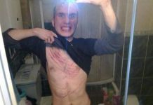 ‘Pankeri’ napali branitelje u ‘Savskoj’