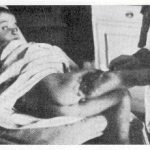 Četnici su unakazivali i ranjavali djecu kao
ovog dječaka u Goraždu.