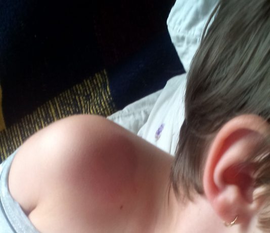 Maloljetni Srbi napali i pretukli djevojčicu hrvatske nacionalnosti u školi