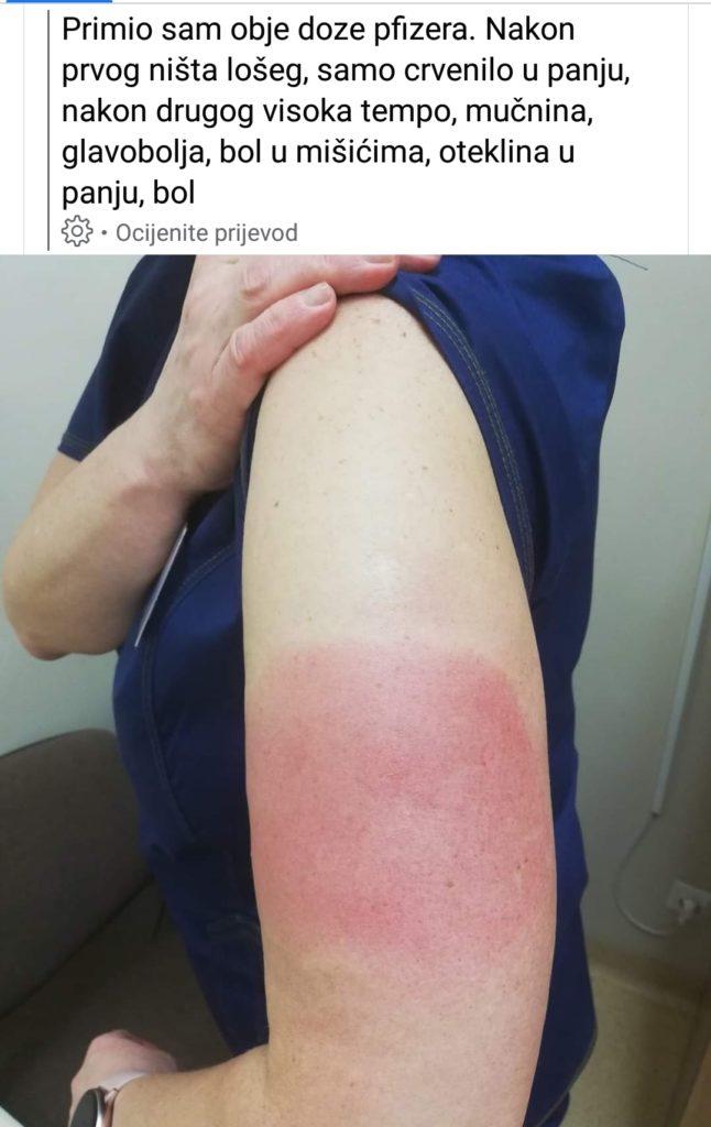 inbound6490759256339044336