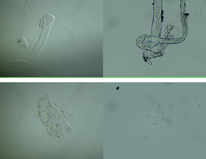 Slika 2 b sastav cjepiva