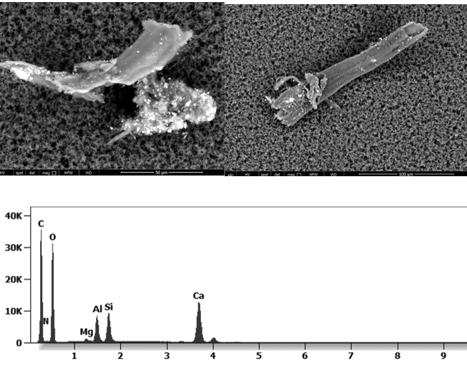 slika 15 sastav cjepiva