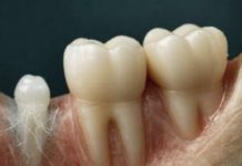 Japanci započinju prvo ispitivanje lijeka za ponovni rast zuba