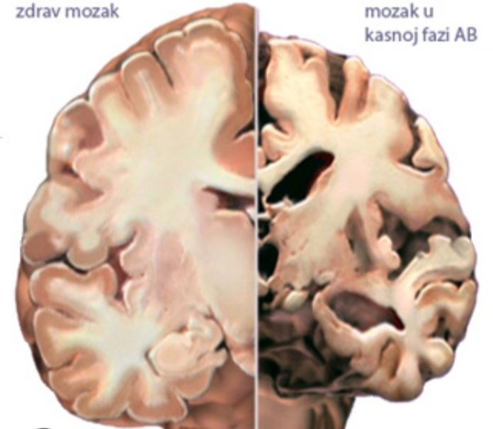 Screenshot_20250814-115859_Google