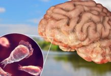 Naegleria fowleri -ameba koja jede mozak