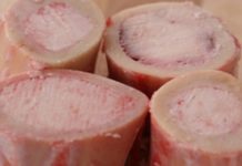 Sve bolesti počinju kada koštana struktura oslabi