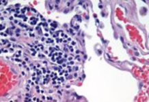 Ruski histolog Aleksandar Maksimov (1874.-1928.) napisao je “najcjenjeniji udžbenik u svijetu histologiji”