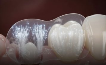 Južna Koreja razvila je flaster koji regenerira zube