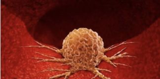 Imunološki sustav ne smatra tumorsku stanicu stranom, jer ona to nije