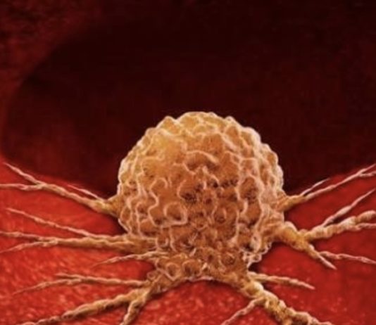 Imunološki sustav ne smatra tumorsku stanicu stranom, jer ona to nije