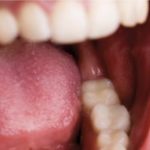 Vrsta virusnog entiteta koji nastanjuje bakterije i žive u ljudskim ustima i crijevima