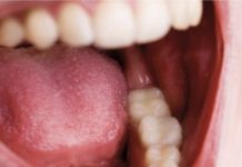 Vrsta virusnog entiteta koji nastanjuje bakterije i žive u ljudskim ustima i crijevima