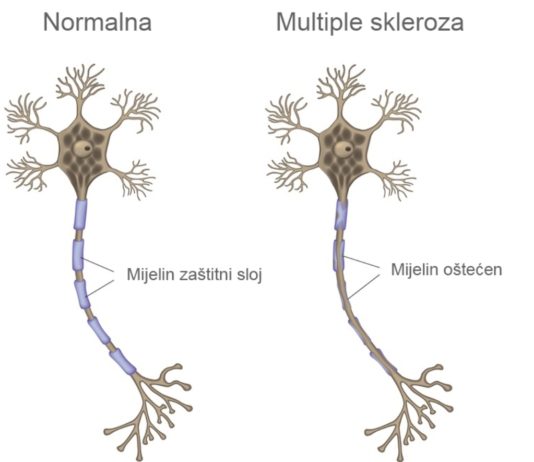 Ekskluzivno: TALIJANSKI ZNANSTVENICI OTKRIVAJU TRIK S VIRUSOM