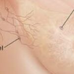 Reishi gljiva može pomoći u usporavanju rasta stanica raka dojke