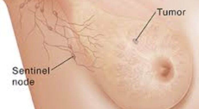 Screenshot_20260304_142039_Google