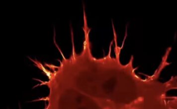 Tumorske stanice su veće jer stanica više ne prepoznaju signale tijela