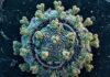 Epstein-Barrov virus (EBV) mogao bi igrati ključnu ulogu u razvoju multiple skleroze