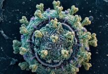 Epstein-Barrov virus (EBV) mogao bi igrati ključnu ulogu u razvoju multiple skleroze