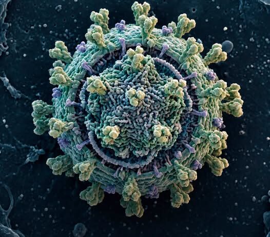 Epstein-Barrov virus (EBV) mogao bi igrati ključnu ulogu u razvoju multiple skleroze